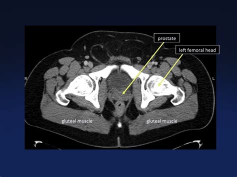 Cross Sectional Anatomy Of The Body Mdct Atlas Ct Scanning