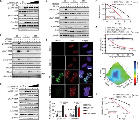 Aberrant Atm Signaling And Homology Directed Dna Repair As A