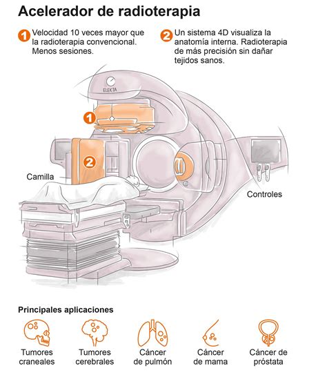 Acelerador Lineal Radioterapia Infograf A Cl Nica Universidad Navarra