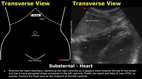 Fast Ultrasound Scan Probe Positioning Transducer Placement Usg