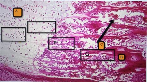 Developing Bone Histology Slide Diagram Quizlet