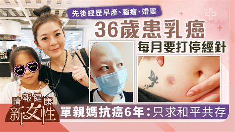 健康新女性︳36歲患乳癌每月要打停經針 單親媽抗癌6年自強：只求和平共存 晴報 健康 腫瘤及癌症 D220516