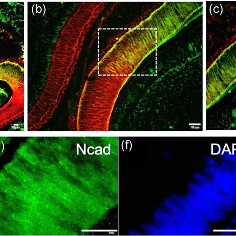 Coexpression Of Ecadherin And Ncadherin During Enamel Development