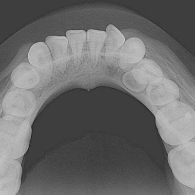 Radiografia Oclusal Unimagem Radiografia Odontológica Curitiba