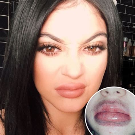 Kylie Jenner Lip Challenge Produces Terrifying Results E Online Uk