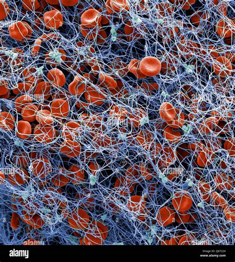red blood cells  platelets  blood clot sem stock photo alamy