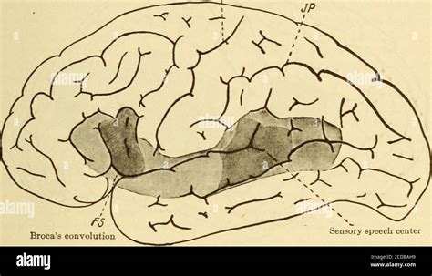 Diseases Of The Nervous System Rain Or In Those In Which There Is A Predominant