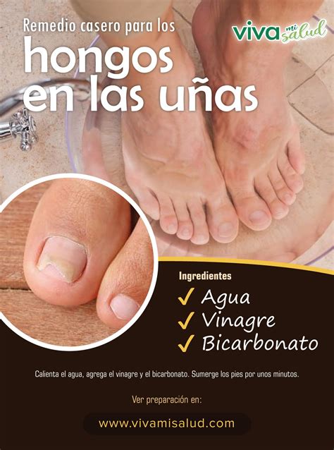 Sintetiza 56 imágenes sobre hongos en las uñas de los pies