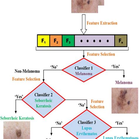 Flowchart For Classification Of Three Skin Diseases Download