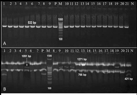 Agrose Gel Electrophoresis Showing PCR Products Of 21 Amplified B