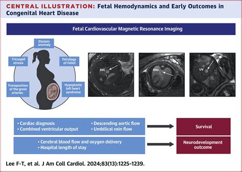 Fetal Hemodynamics Early Survival And Neurodevelopment In Patients