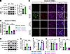 Jci Endothelium Derived Semaphorin G Attenuates Ischemic Retinopathy