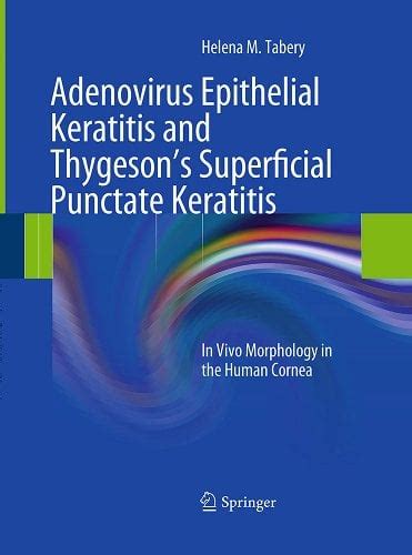 Adenovirus Epithelial Keratitis And Thygesons Superficial Punctate Keratitis In Vivo