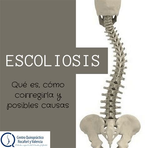 La Escoliosis Qué Es Cómo Mejorarla Y Posibles Causas