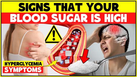 Signs Your Blood Sugar Is High Diabetes Symptoms And Hyperglycemia