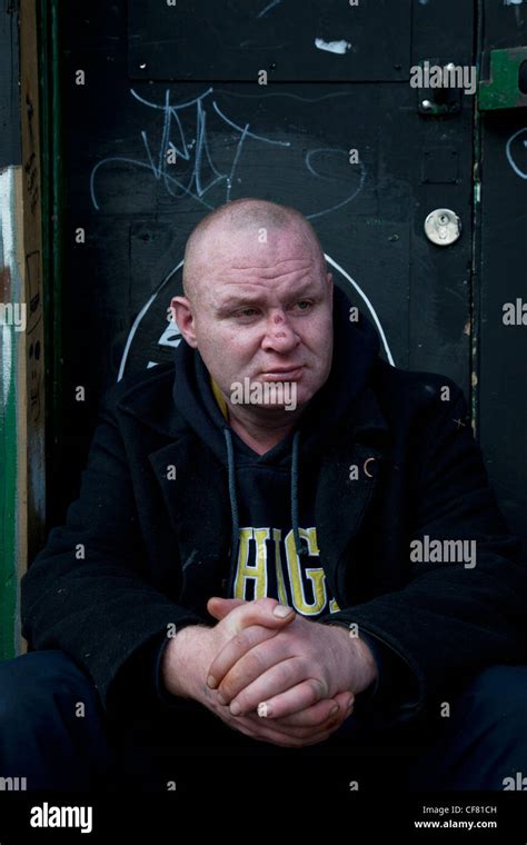 Homeless Man John Sitting In Spitalfields London Drinking A Can Of