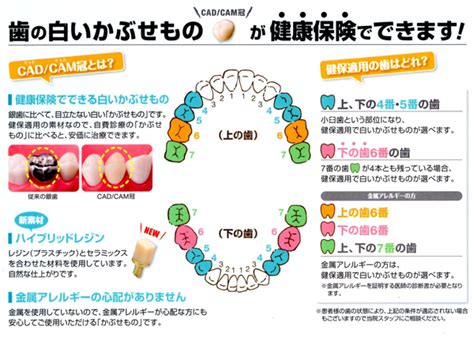 保険で出来る奥歯の白いかぶせもの（白い歯）、cadcamキャドキャム冠について ※令和6年6月更新 佐々木歯科医院