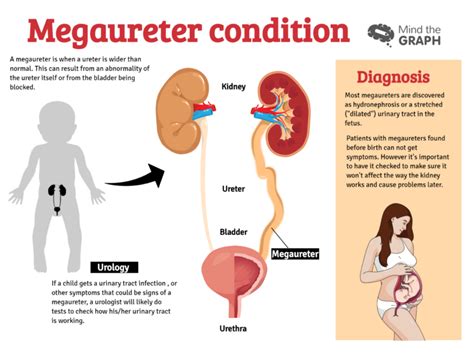 Urinary System Diseases Infographics To Understand Mind The Graph