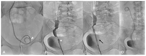 Diagnostics Free Full Text Diagnostic And Interventional Radiology