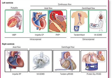 Figure From Nursing Management Of Patients Requiring Acute Mechanical