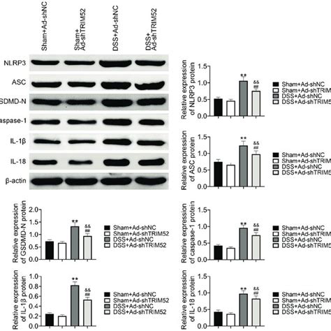 TRIM52 Knockdown Inhibited DSS Induced Pyroptosis In Colon Tissue