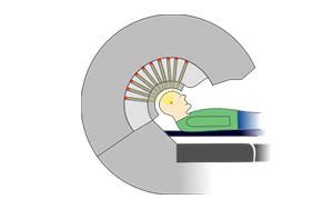 Gamma Knife Präzisionsbestrahlung Medizinische Physik