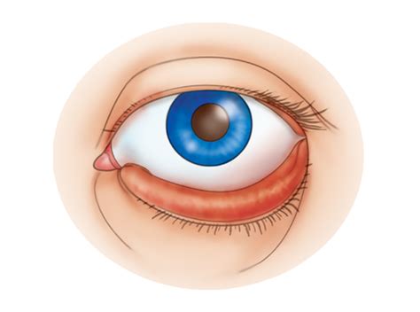 Chapter 11 Special Senses The Eyes And Ears Flashcards Quizlet