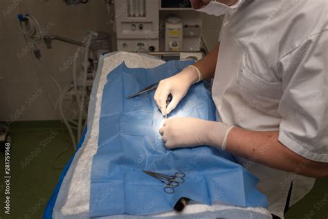 Vet Doing The Operation For Sterilization The Cat On The Operating