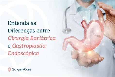 Entenda As Diferen As Entre Cirurgia Bari Trica E Gastroplastia Endosc Pica