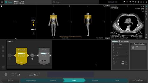 Instinx Workflow Automation Computed Tomography Ct Scanners Canon