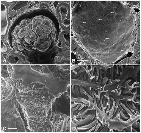 Evaluation Of The Glomerular Filtration Barrier By Electron Microscopy