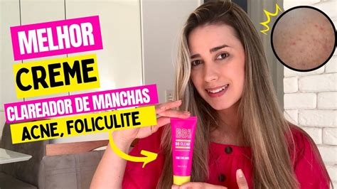 COMO CLAREAR AS MANCHAS DE ACNE FOLICULITE VIRILHA Use BB Clear