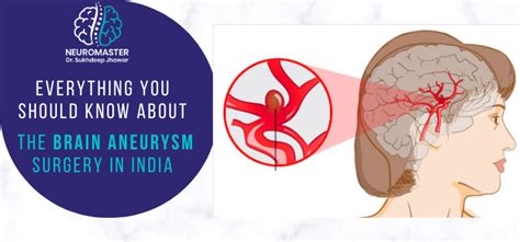 Everything you should know about the brain aneurysm surgery in India