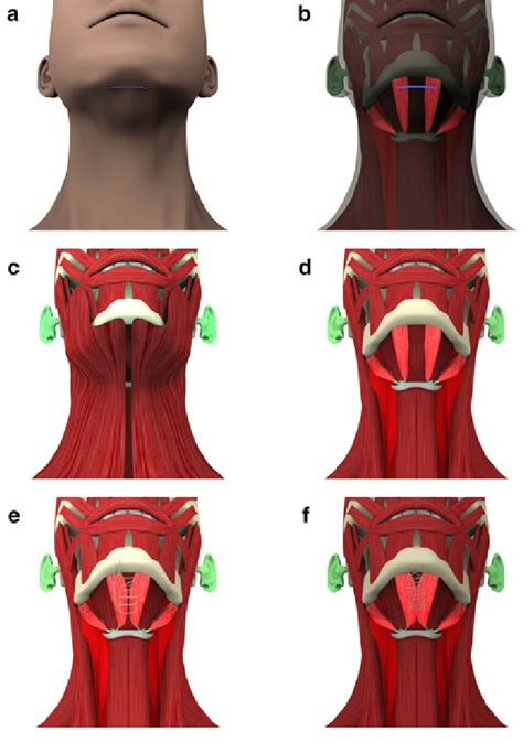 Principles Of The Surgical Procedure A Incision Is Made In The