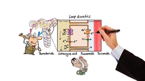 Furosemide Mechanism Of Action - Management of severe hyperkalemia in ...