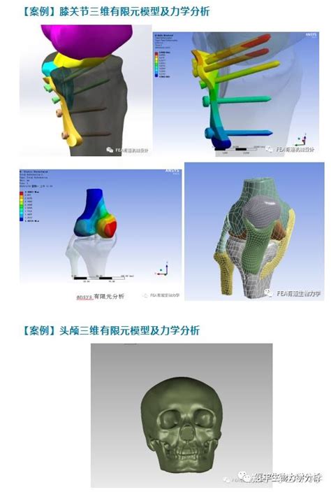 生物力学有限元分析培训及课题项目代做 知乎