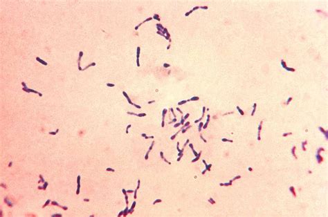 Streptococcus Salivarius Gram Stain