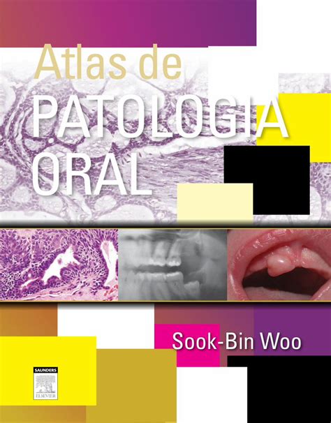 Pdf Atlas De Patologia Oral Dokumen Tips