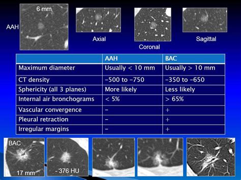 Chest Medicine Made Easy Dr Deepu Radiology