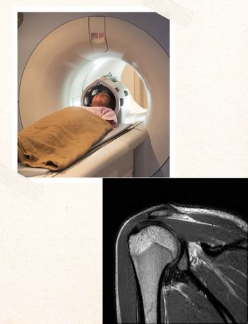 Shoulder Mri Scan Cost In India Mri Scan Machine Images Hot Sex Picture