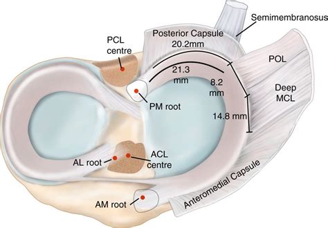 Meniscal Ramp Lesions Musculoskeletal Key