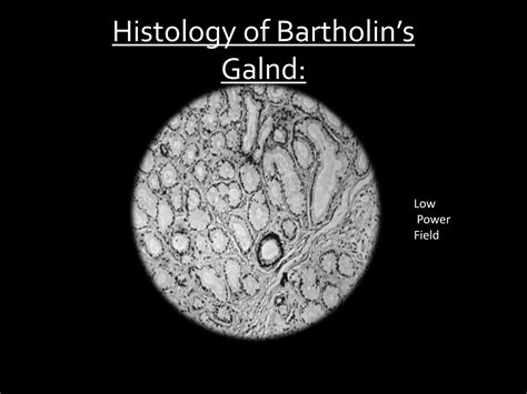 Bartholin gland cyst | PPT