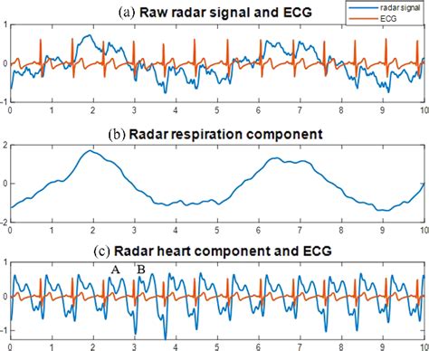 Figure From Non Contact Estimation Of Cardiac Inter Beat Interval And