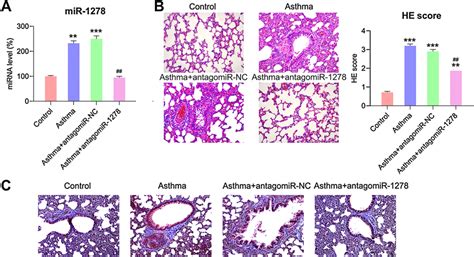 Function Of Mir In Lung Tissues In Asthmatic Mice Mice Were First