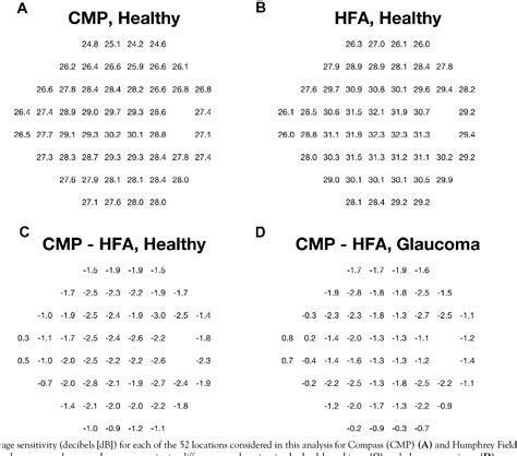 Figure 3 From A Comparison Between The Compass Fundus Perimeter And The