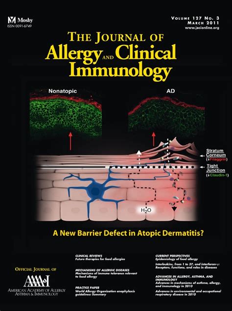 Journal Of Allergy And Clinical Immunology March 2011 Volume 127