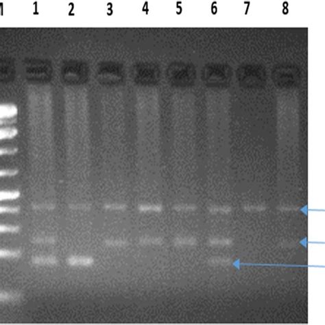 Electrophoresis Gel Of Pcr Products Legend M Molecular Weight Marker Download Scientific