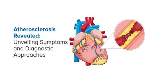 Ampath Lab Atherosclerosis Revealed Unveiling Symptoms And Diagnostic