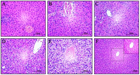 Intra Graft Histopathological Changes Were Improved After Mscs