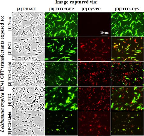 Phase Contrast And Fluorescence Microscopy Of Gfp Transfected L